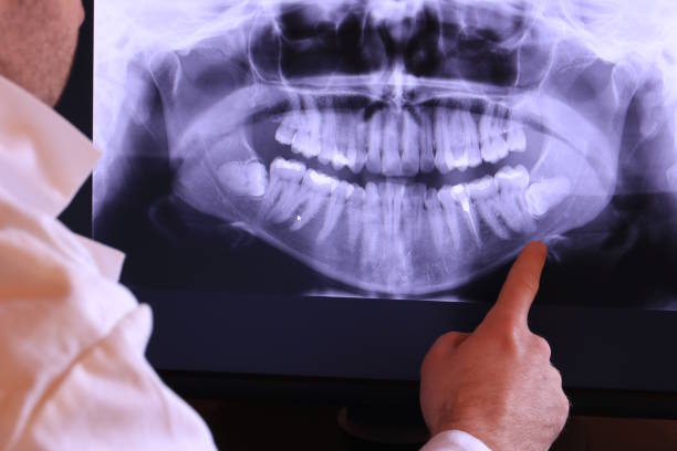 Best Emergency Treatment for Dental Infections or Abscesses in Charleston, IL