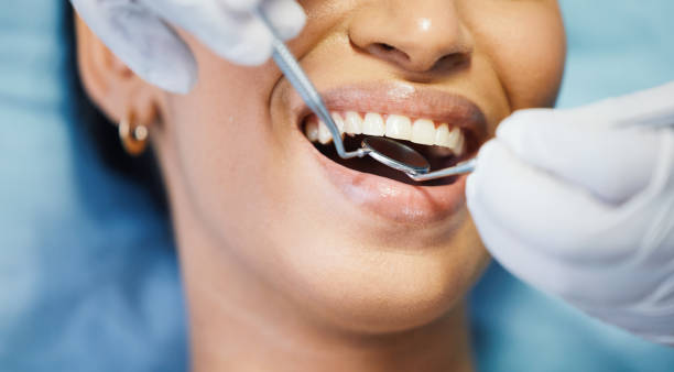 Best Emergency Dental Care for Broken or Chipped Teeth in Charleston, IL