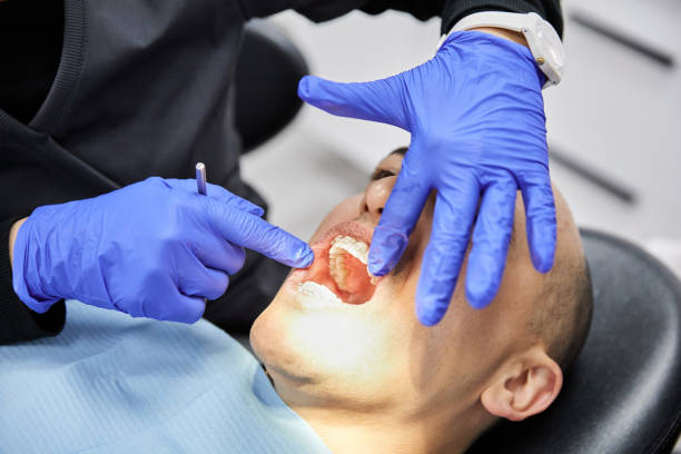 Best Emergency Tooth Extraction in Charleston, IL