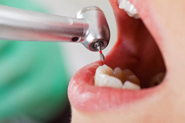 Best After-Hours Dental Trauma Care in Charleston, IL